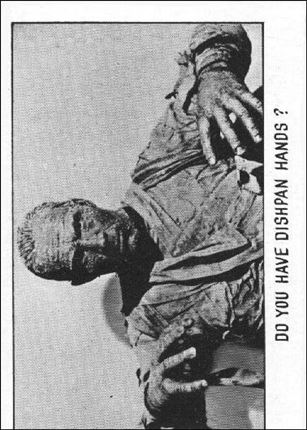 Creature Feature (Base Set) card 92 Do you have dishpan hands?
